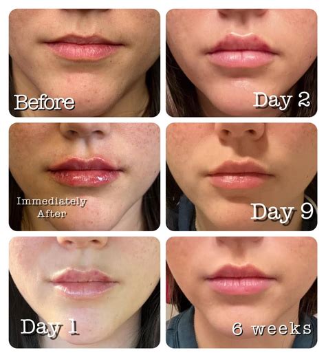 how long does lip oil expire